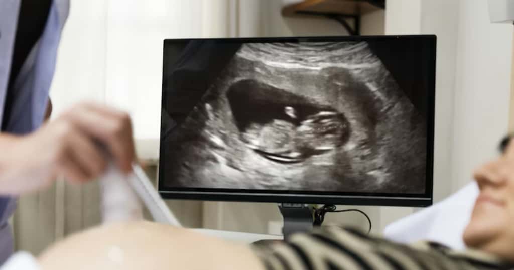 chematische Darstellung der Scheitel-Steiß-Länge (SSL)