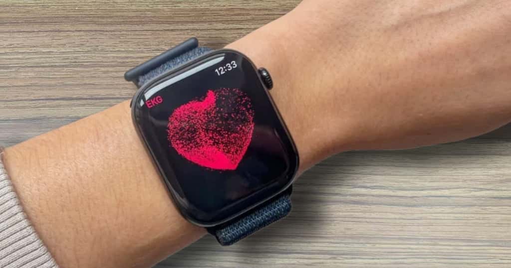 Mi az Apple Watch EKG funkciója