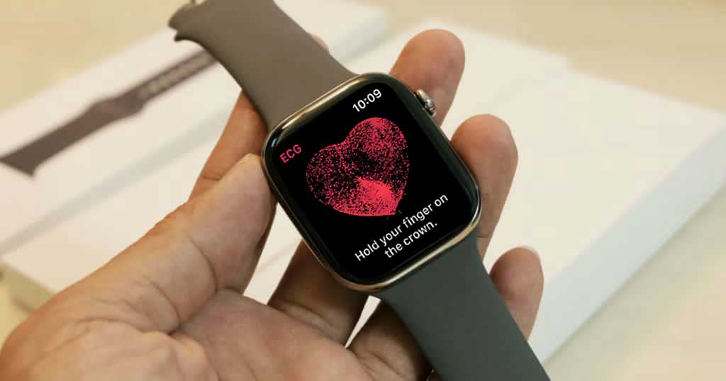 Apple Watch ECG measurement during a short recording