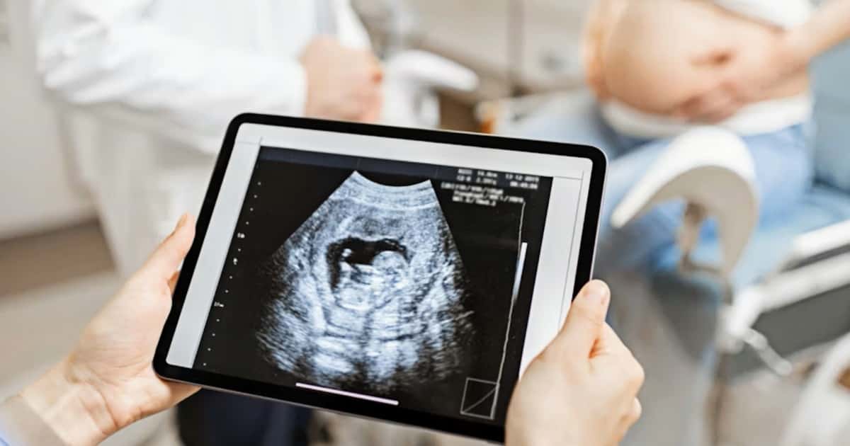 Ultraschalluntersuchung in der Frühschwangerschaft