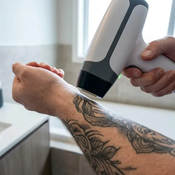 does at home laser hair removal affect tattoos